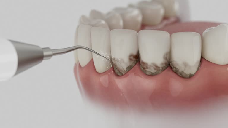 Reliable Dental Implants contractor in Fort Smith, AR by Smile Center Dentistry